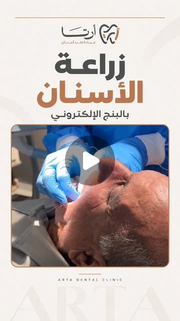 منشور آرتا على انستغرام 2