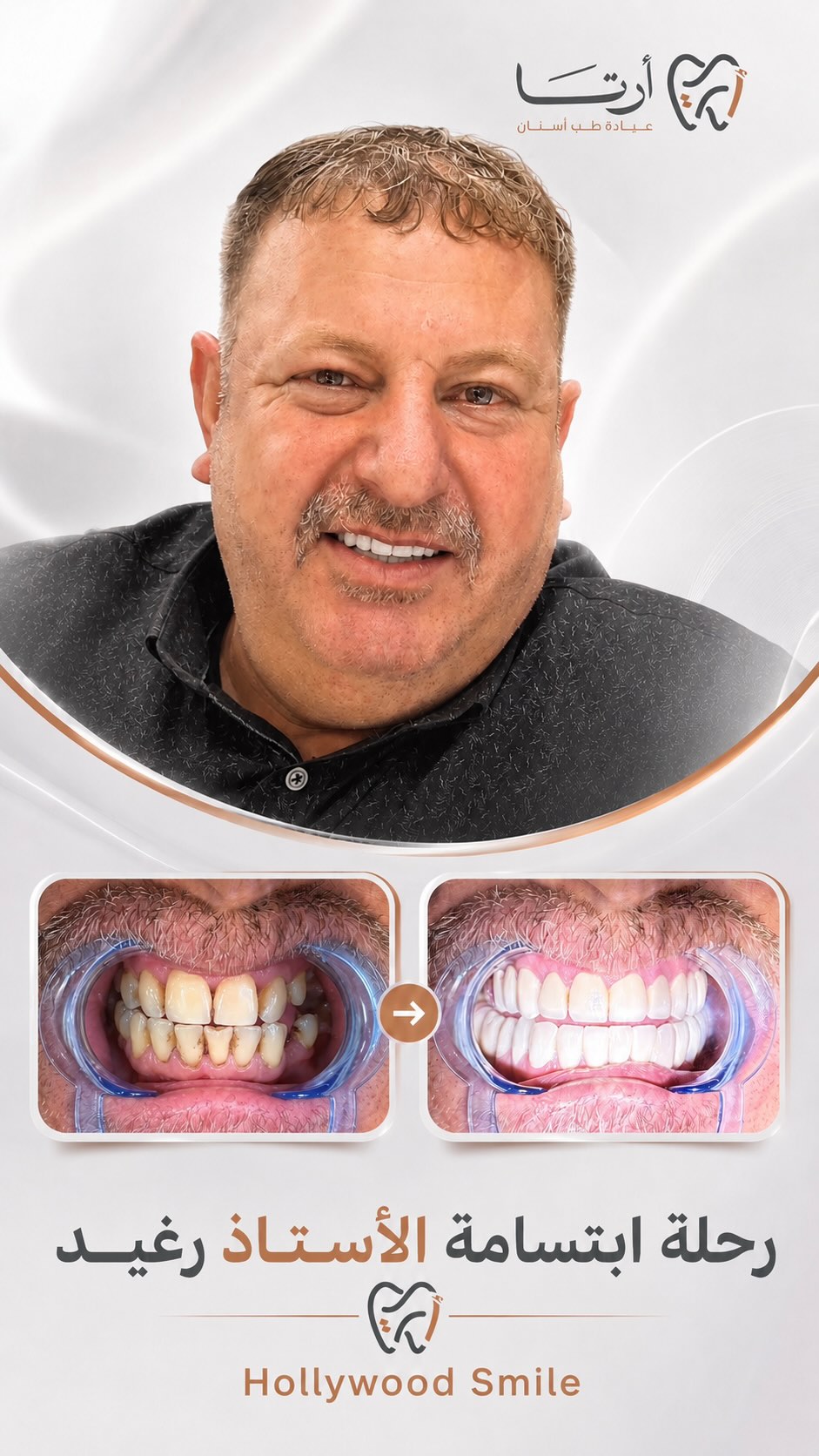 منشور آرتا على انستغرام 7
